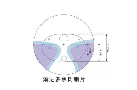 美麗島多焦鏡適合的人群，需要注意的事項